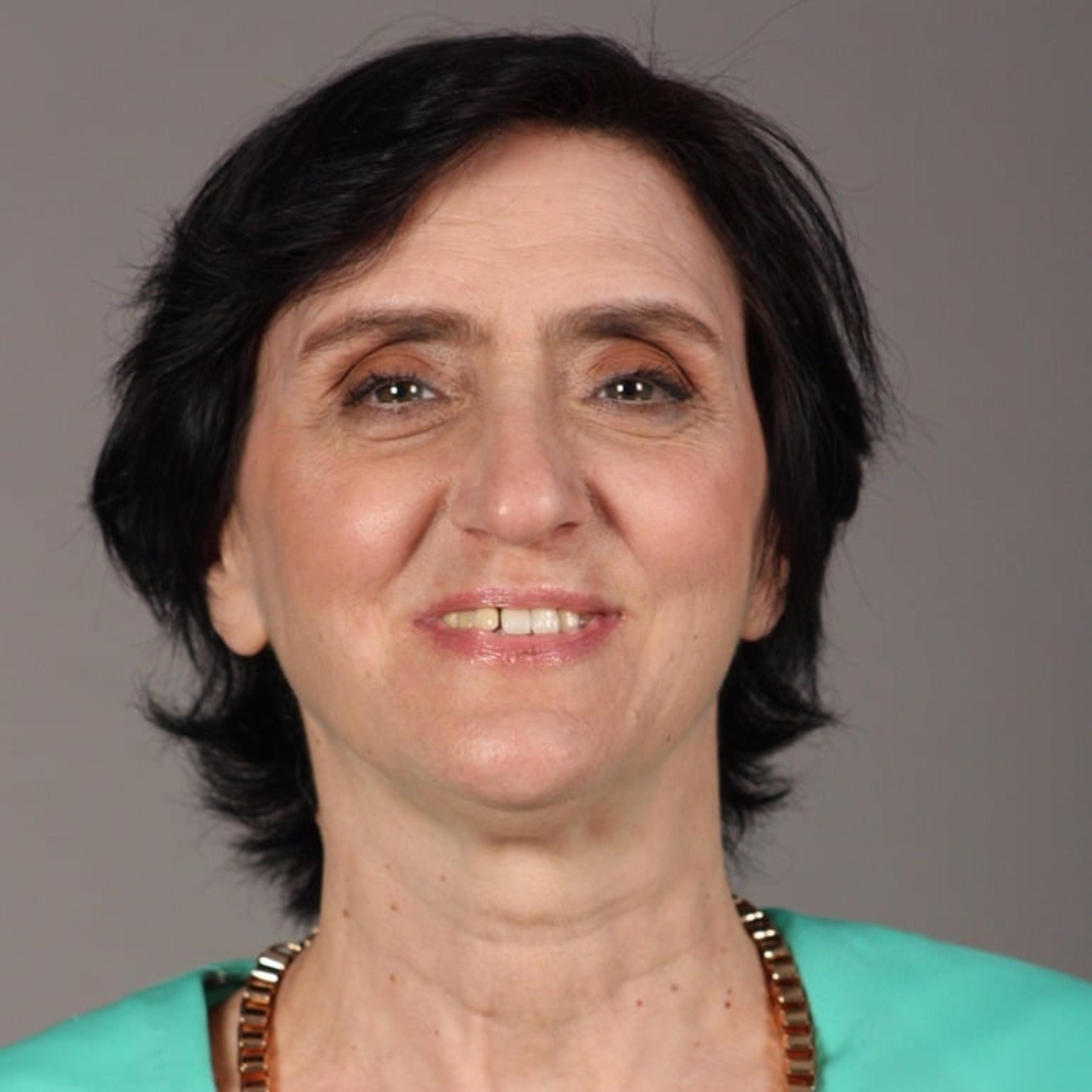 Teresa Audino