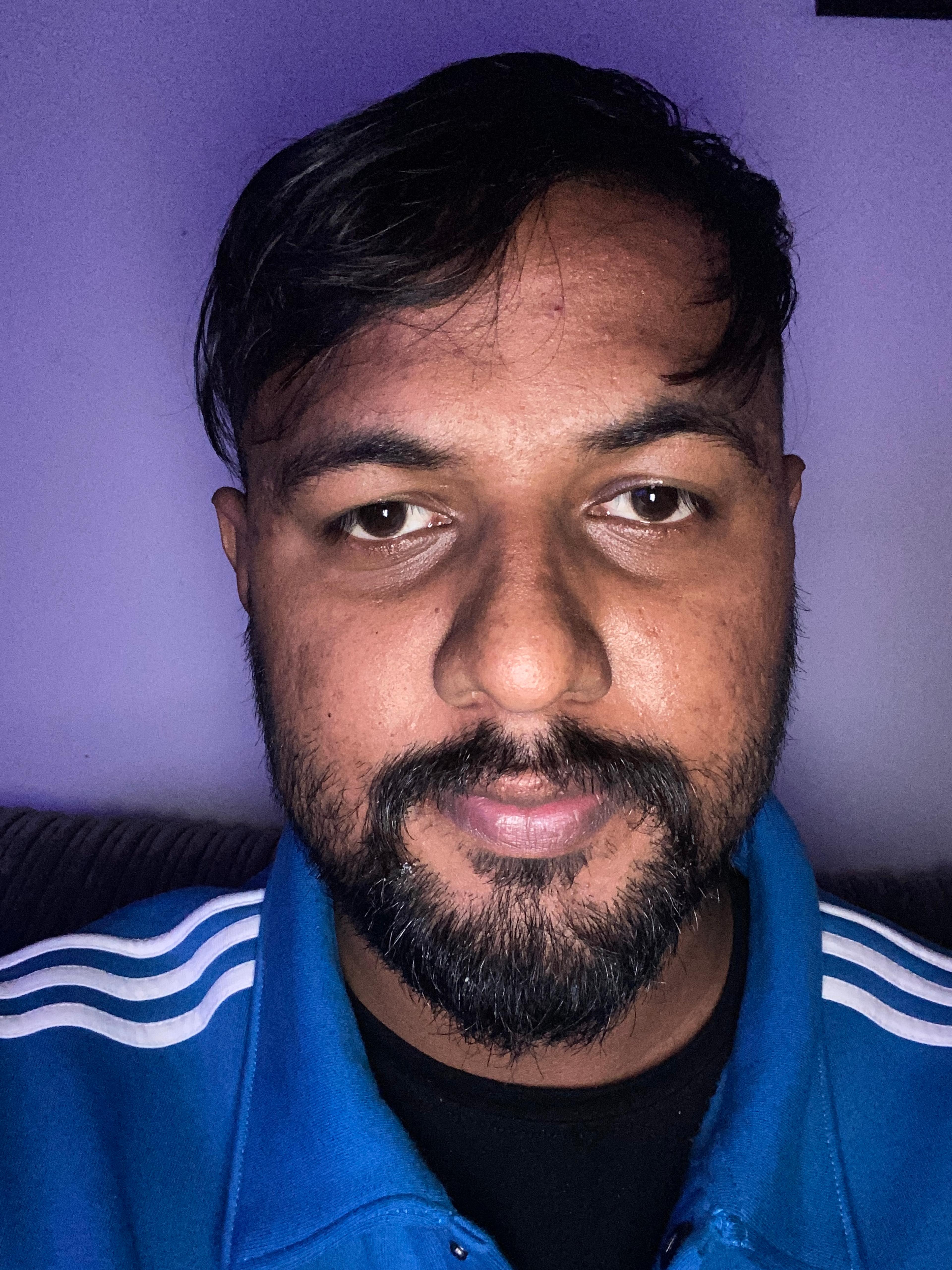 Akash Atwal