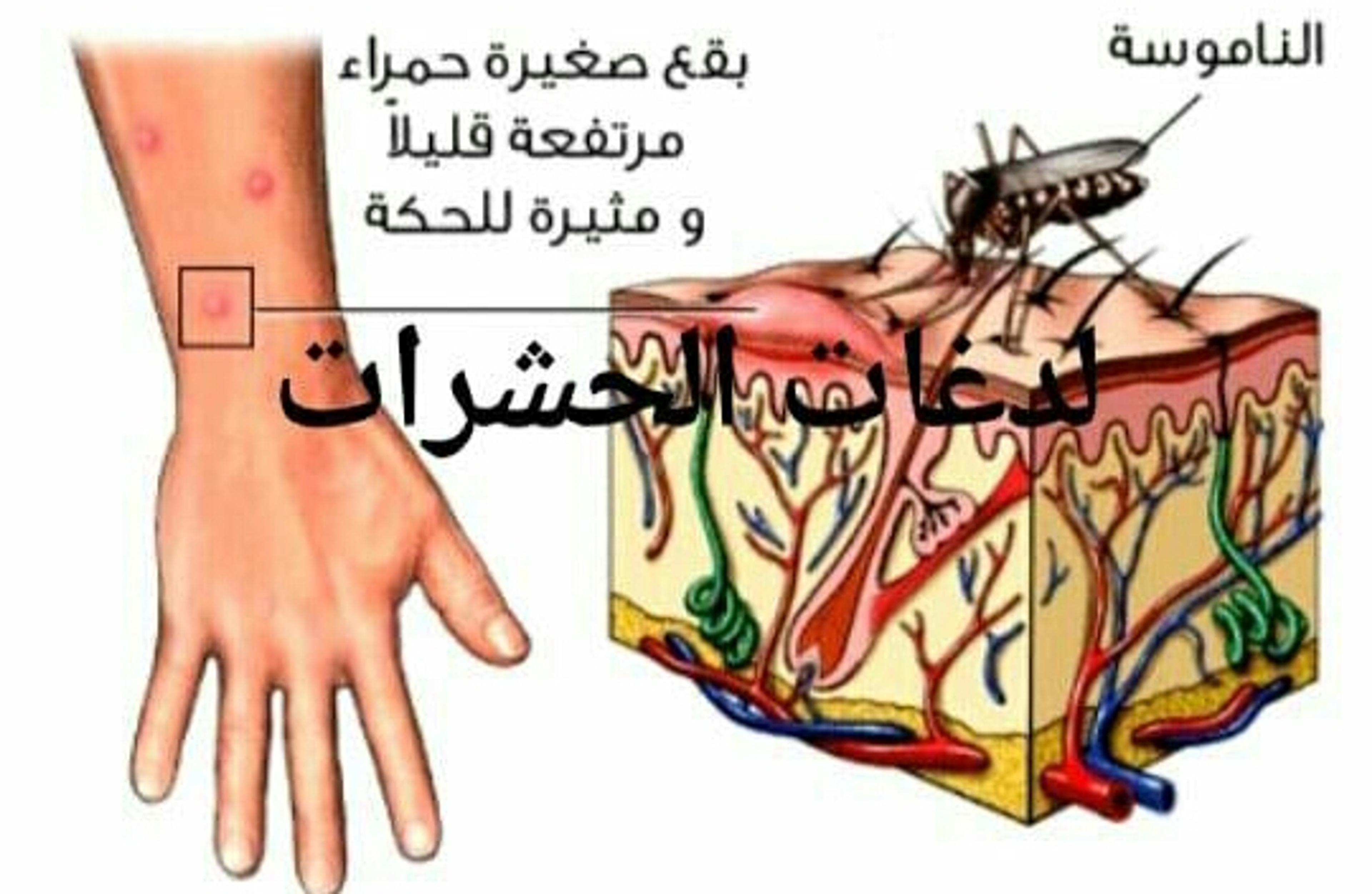 المتحده حشرات