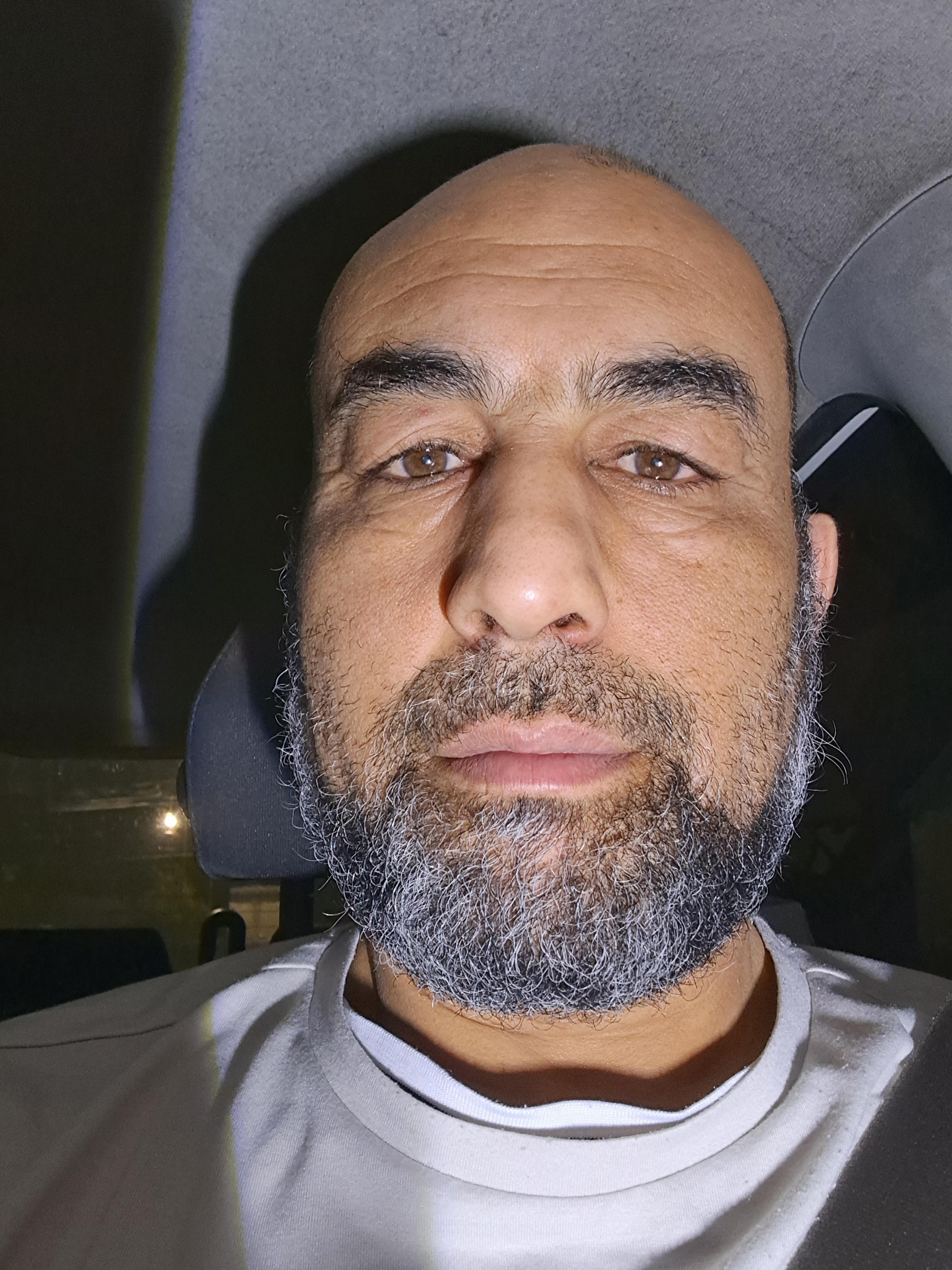 Abdelali Rhizlane