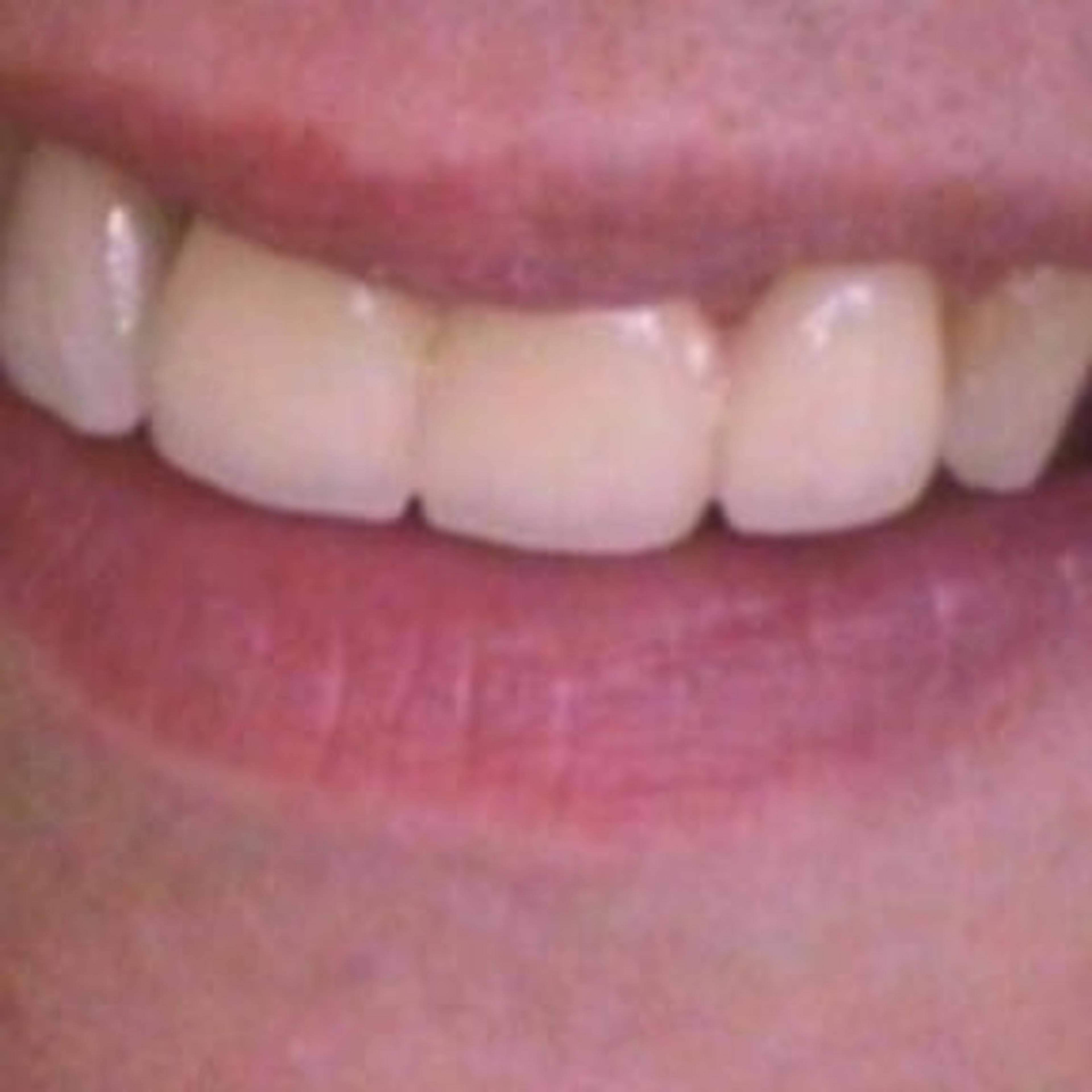 Linea Dent SNC