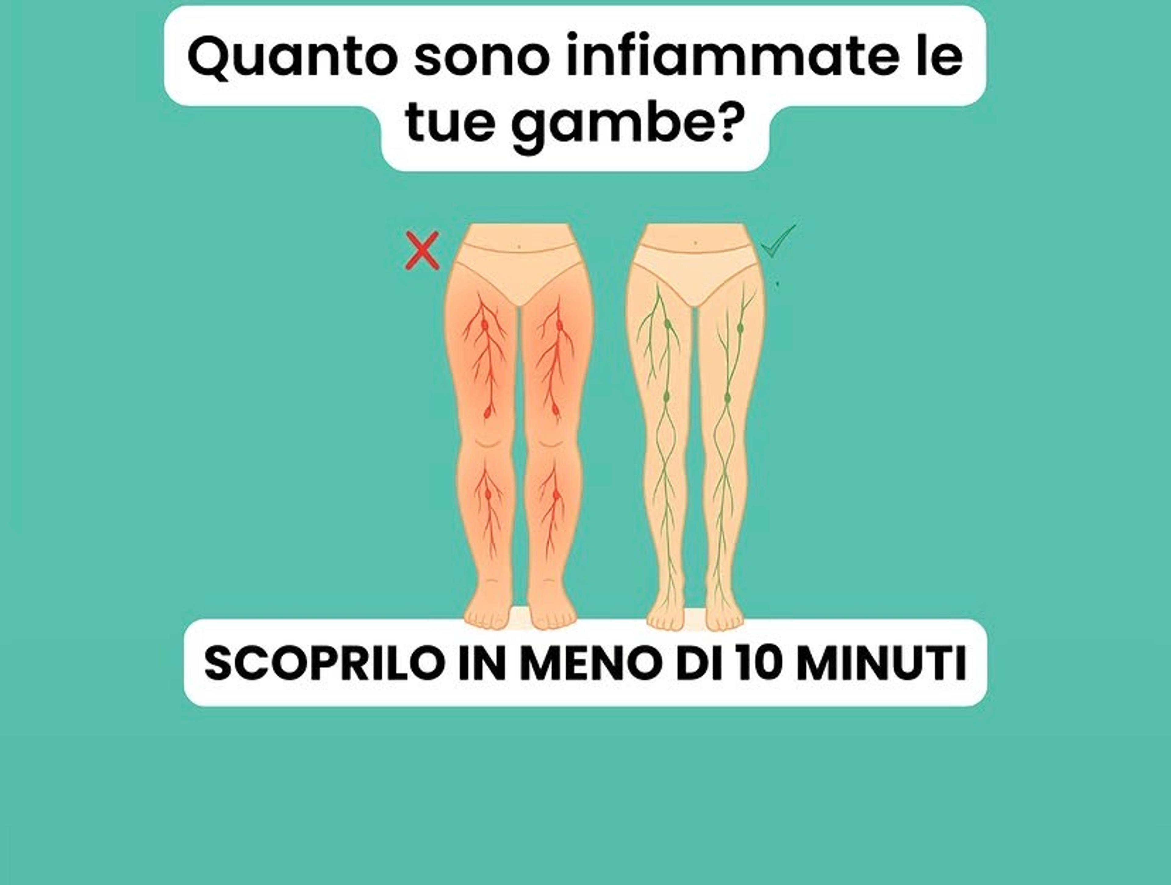Damiano Carcereri