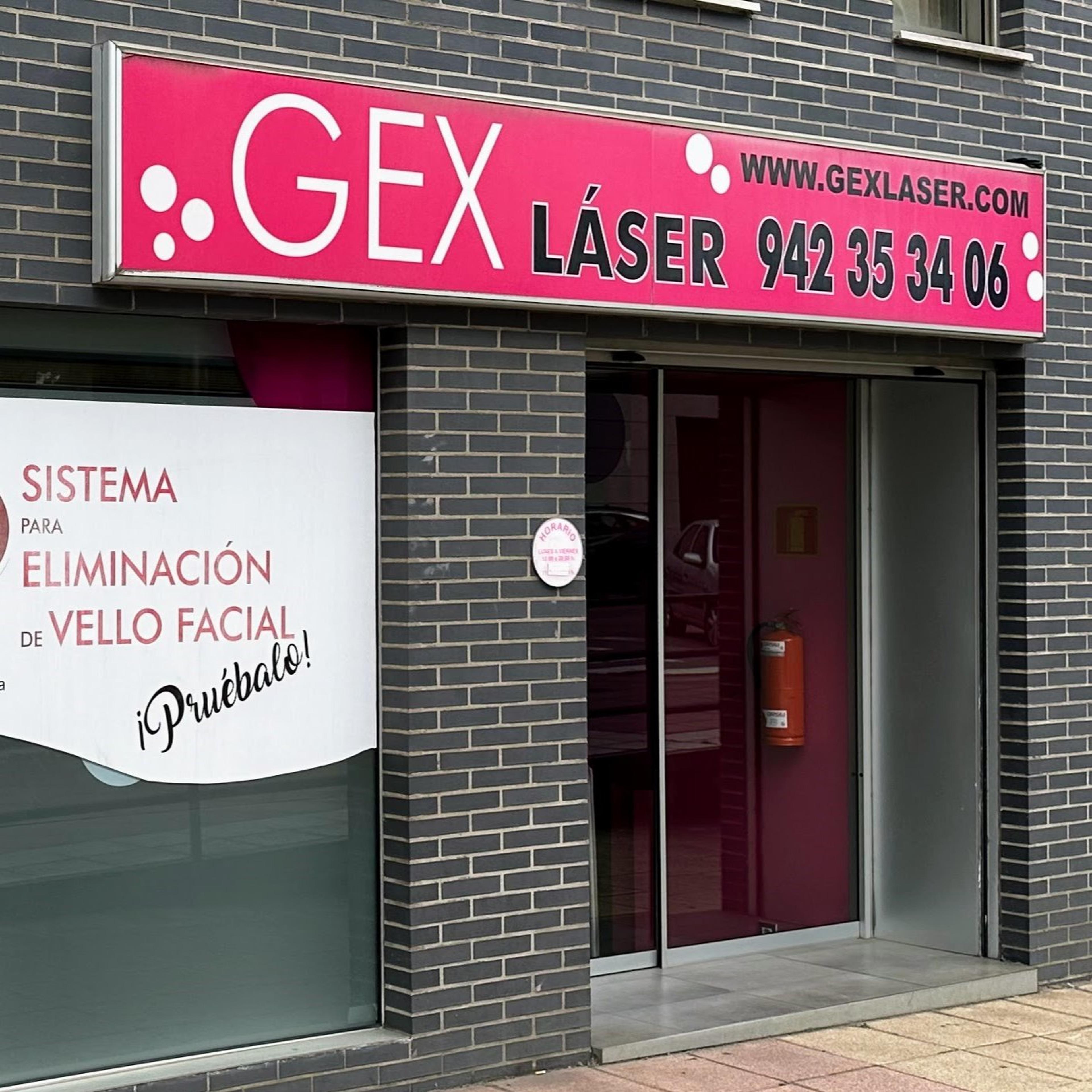 Gexlaser
