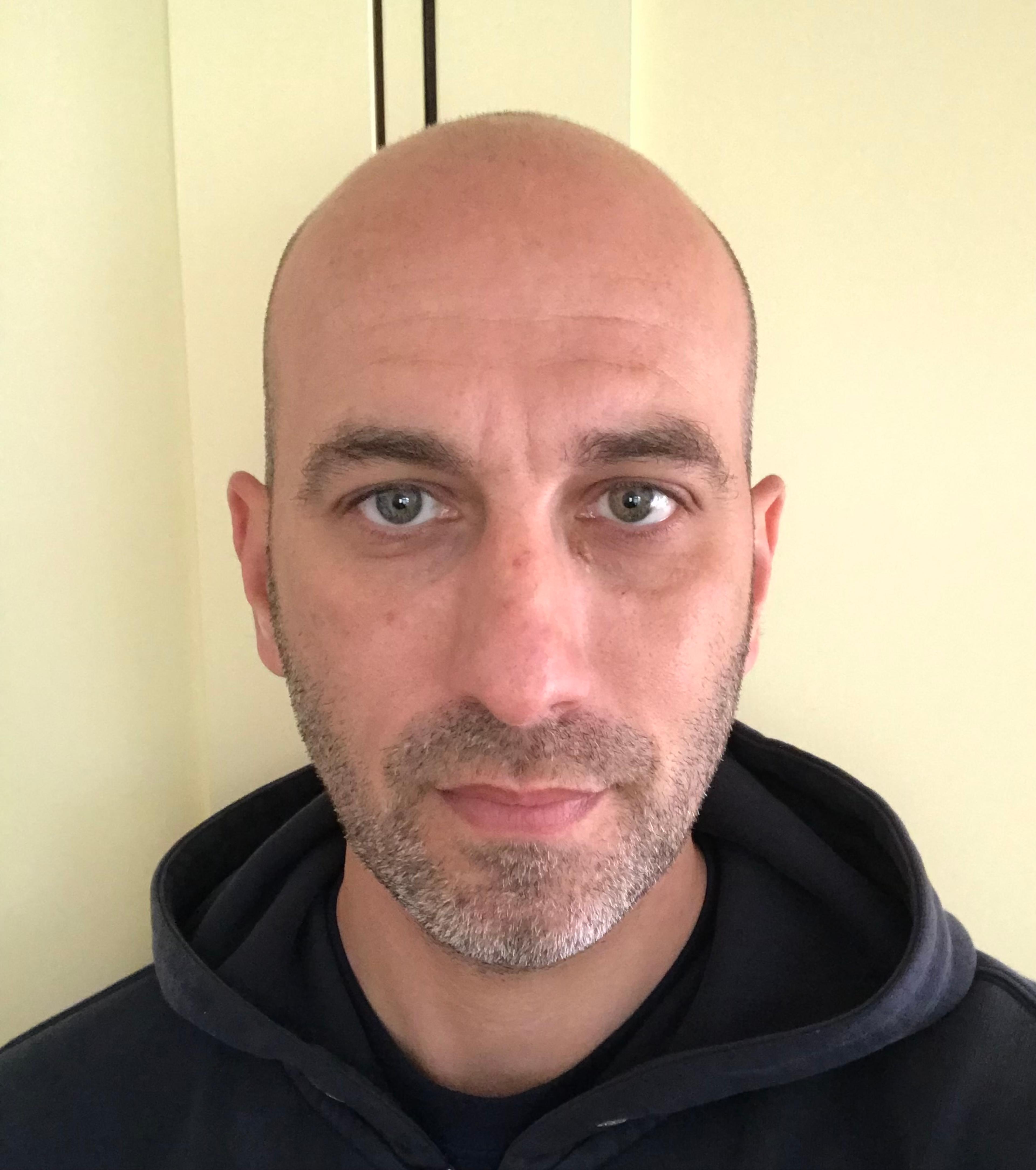 Balazs Szertics