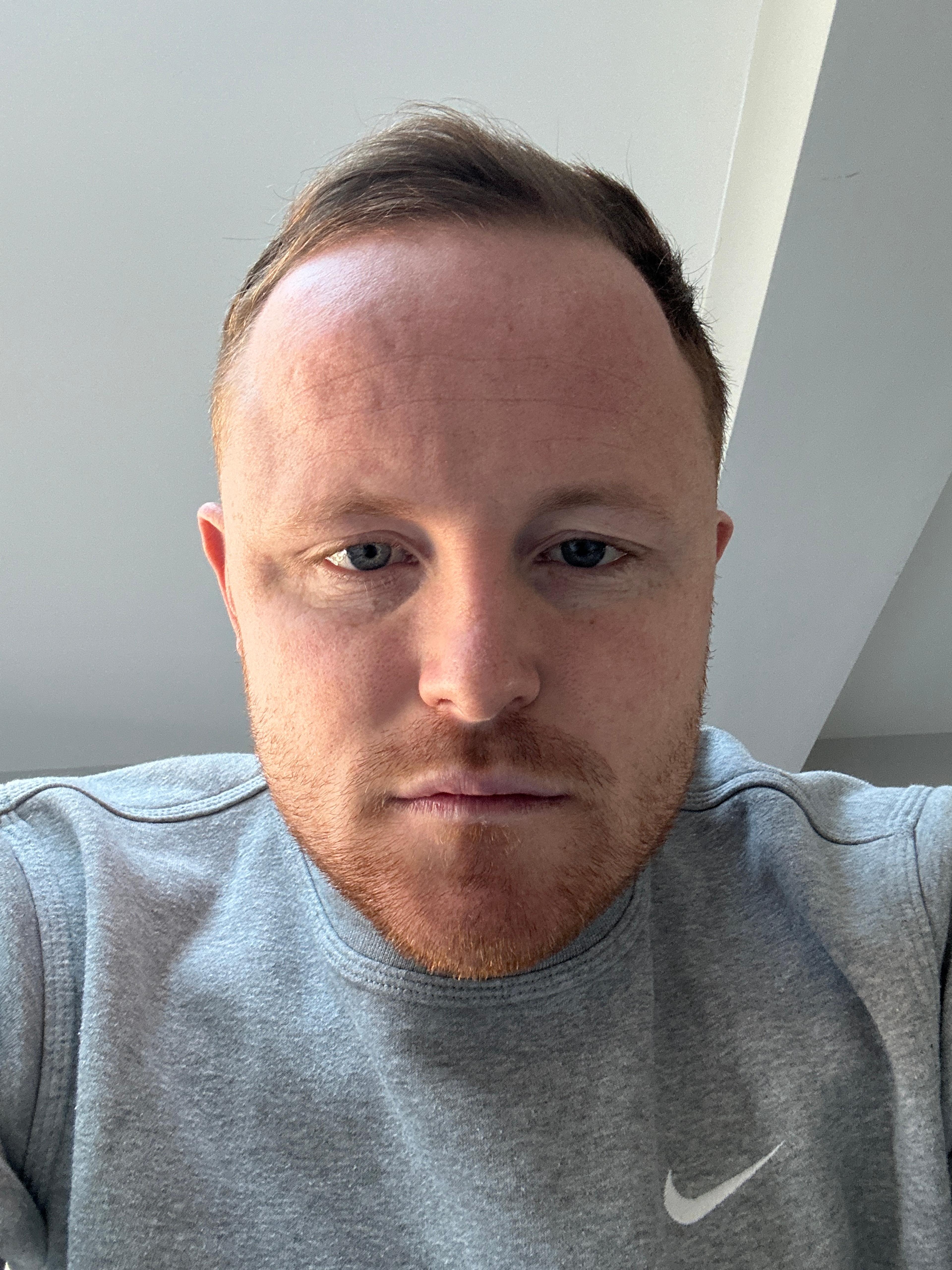 Billy Harling