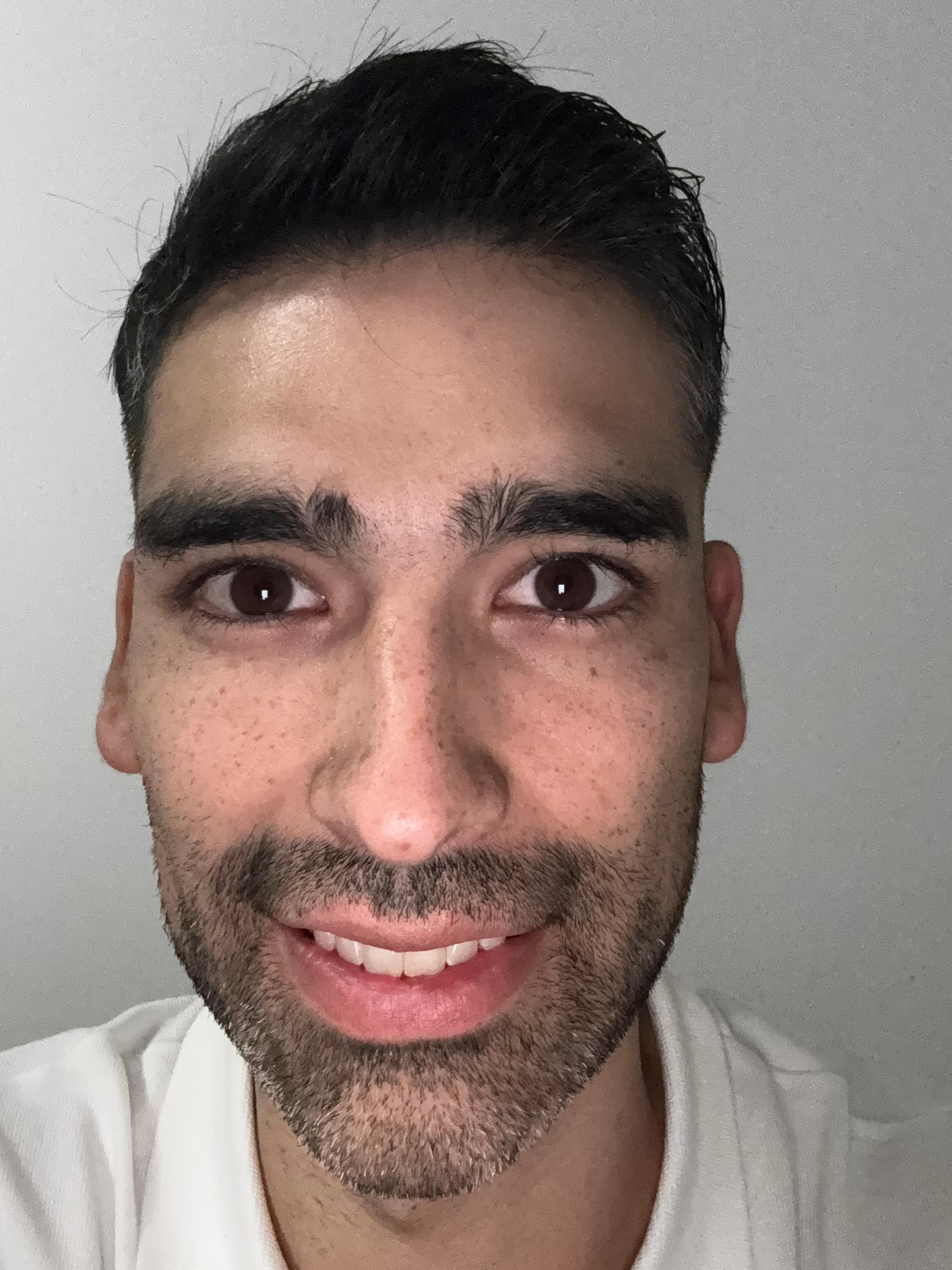 Matias Ledesma
