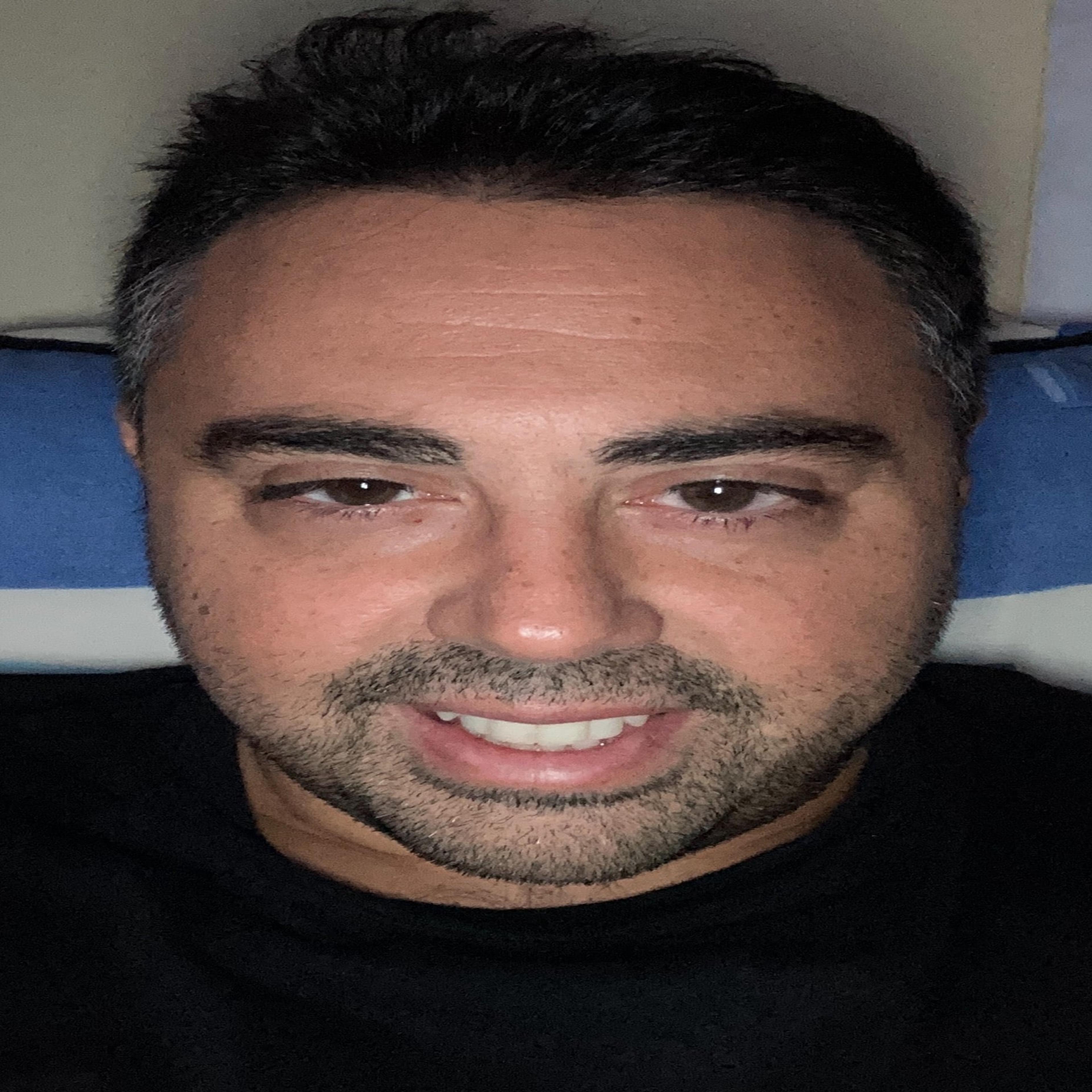 Simone Abbate