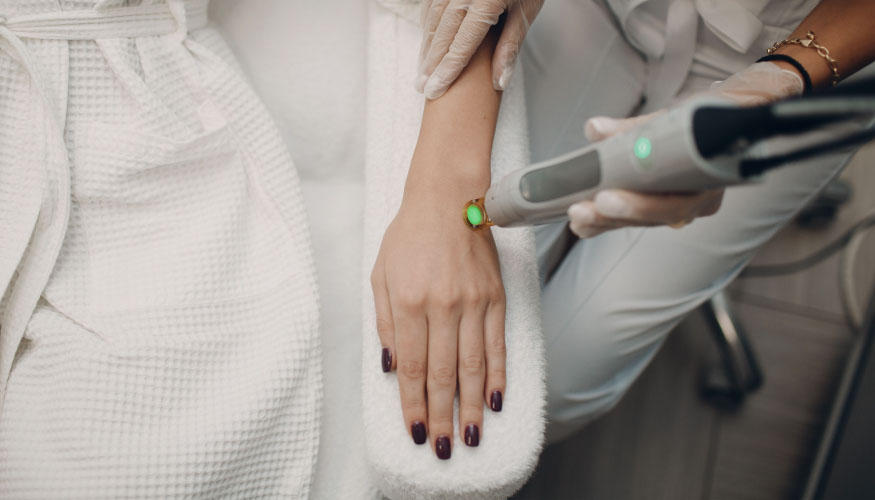 Epilation