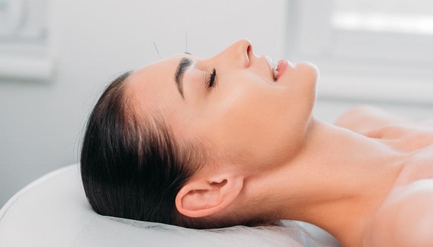 Acupuncture Esthétique