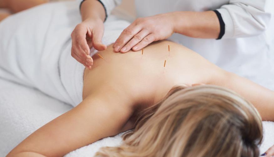 Acupuncture pour Maigrir