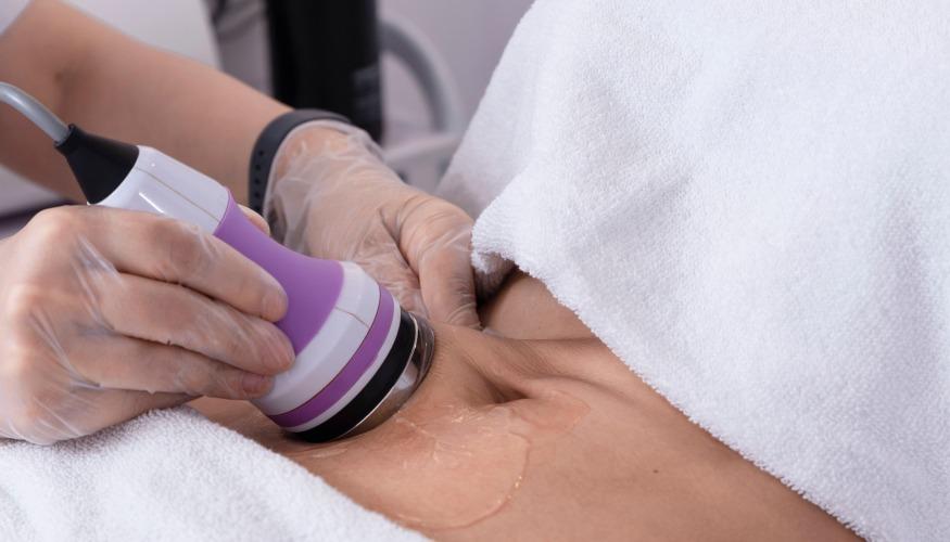 Épilation Électrique