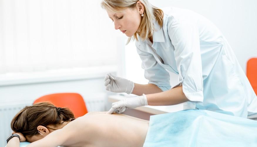 Acupuncture