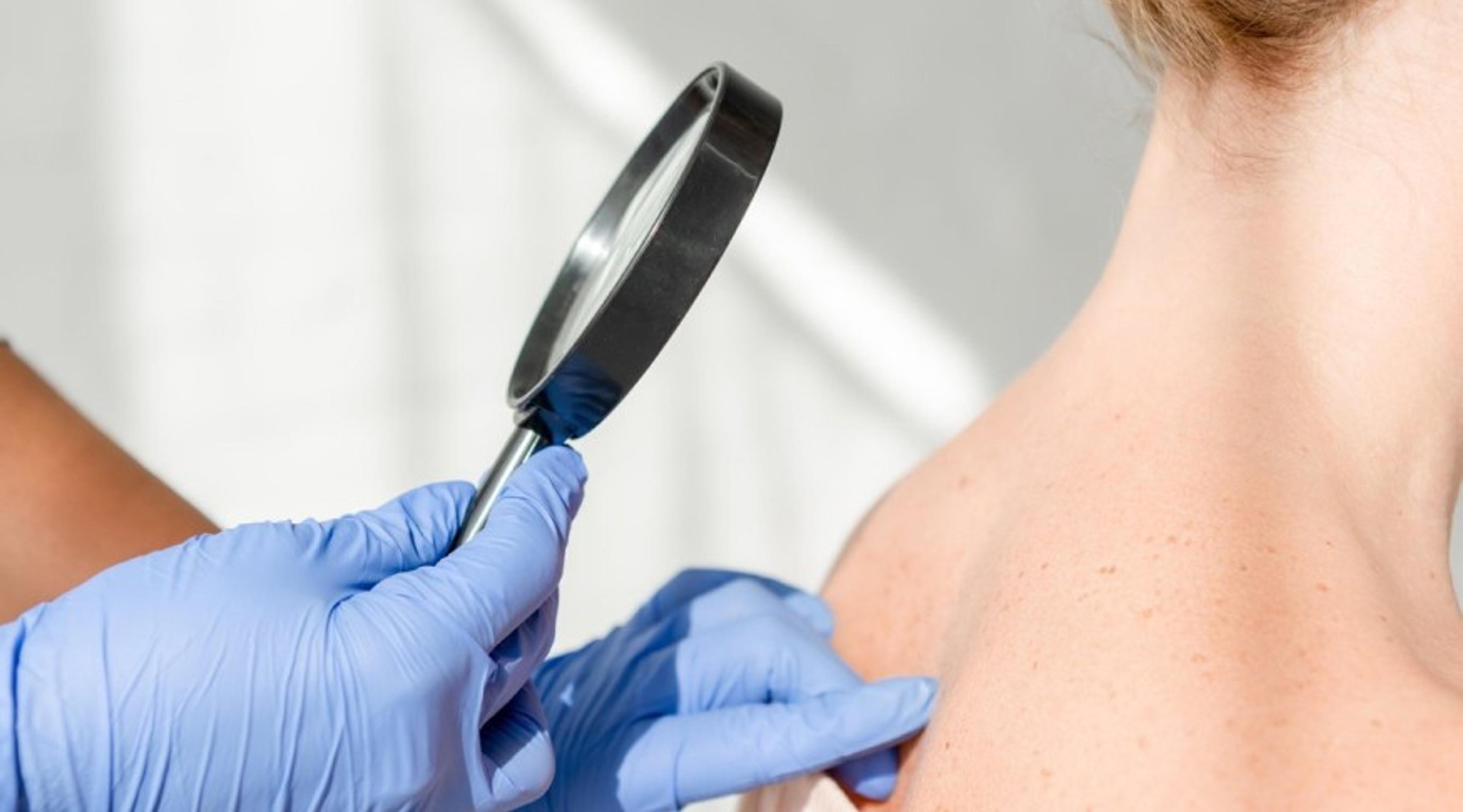 Dermatologue
