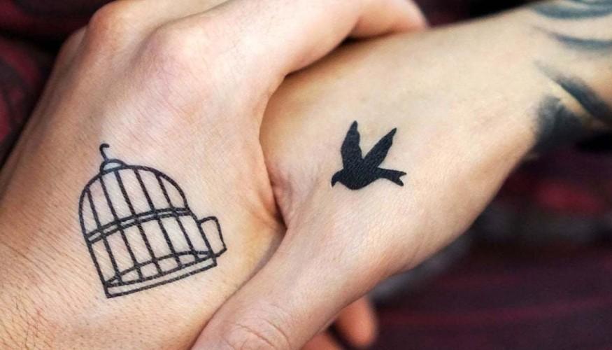 Eliminación de Tatuajes