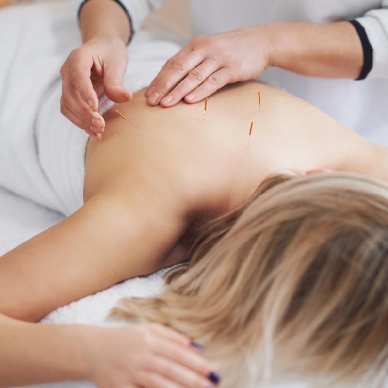 Acupuncture pour Maigrir