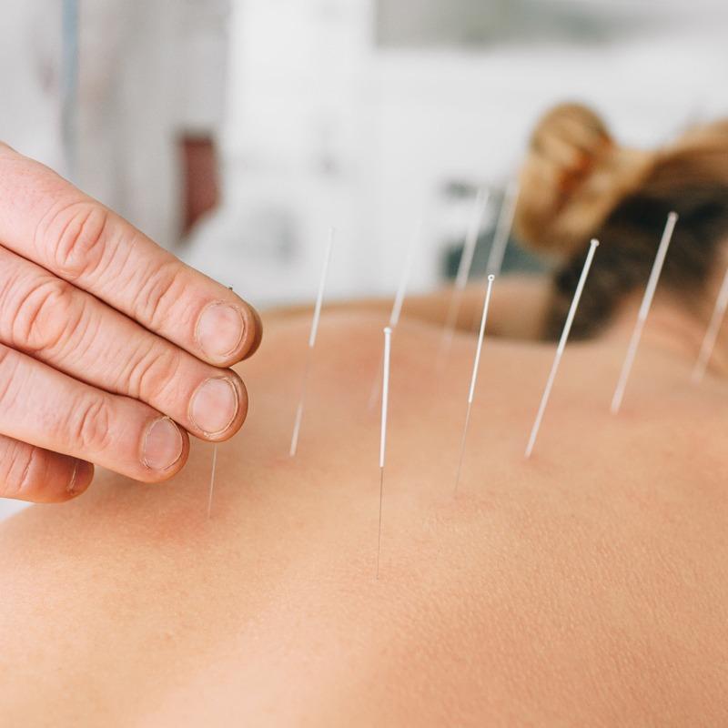 Médecin Acupuncteur