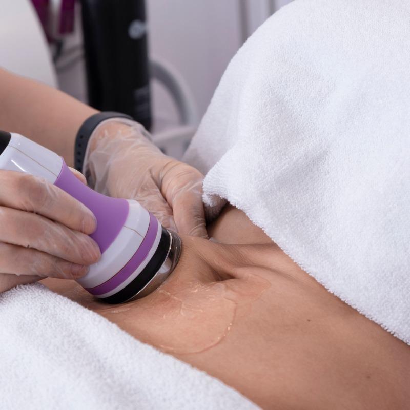 Épilation Électrique