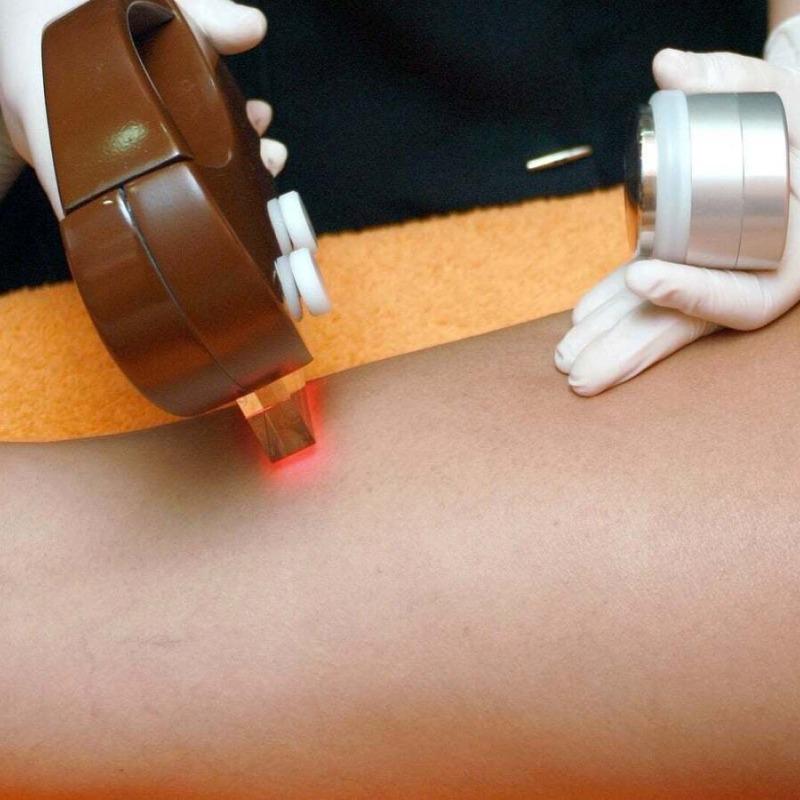 Épilation Lumière Pulsée