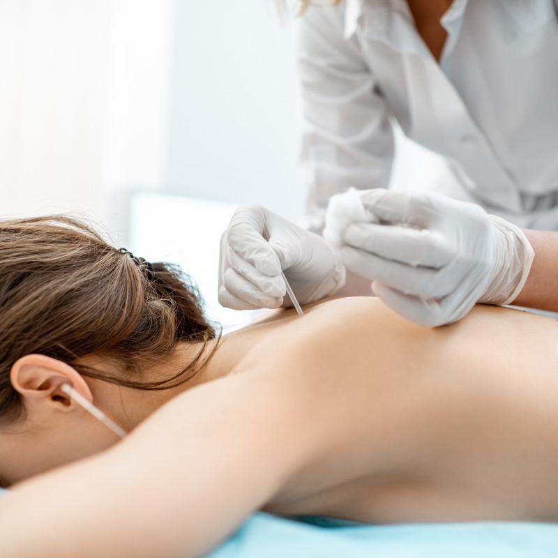 Acupuncture amincissement