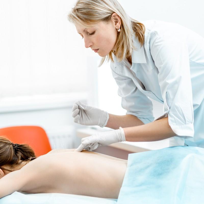 Acupuncture