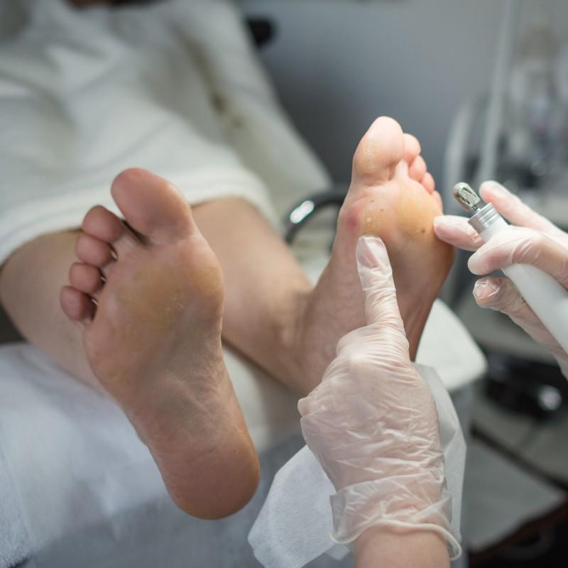 Medikal Ayak Bakımı